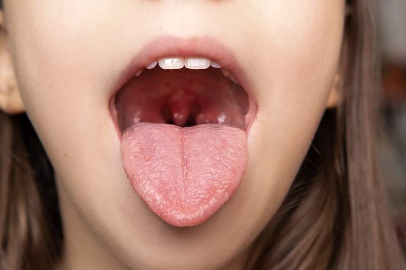Woman experiencing nasal congestion and sinus discomfort