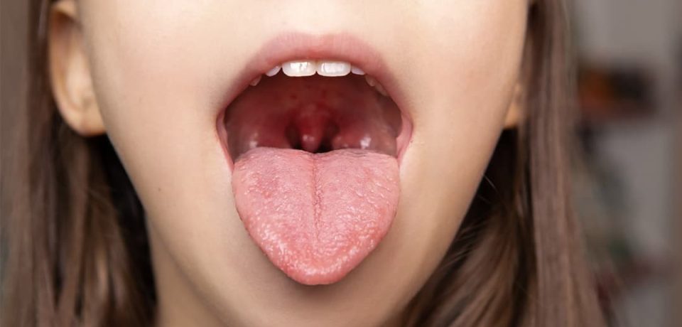 nasal-congestion-and-sinus-discomfort Woman experiencing nasal congestion and sinus discomfort
